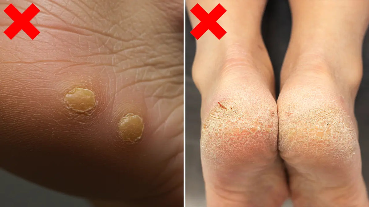 Swissclear Foot Cream