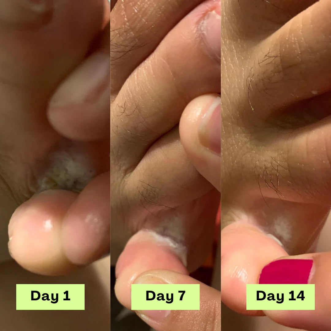 Swissclear Antifungal Soap