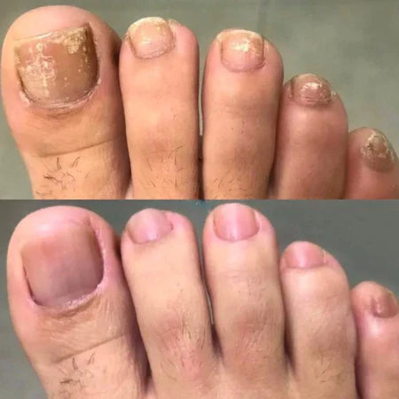 SwissClear Foot Soak - Your path to healthier Nails