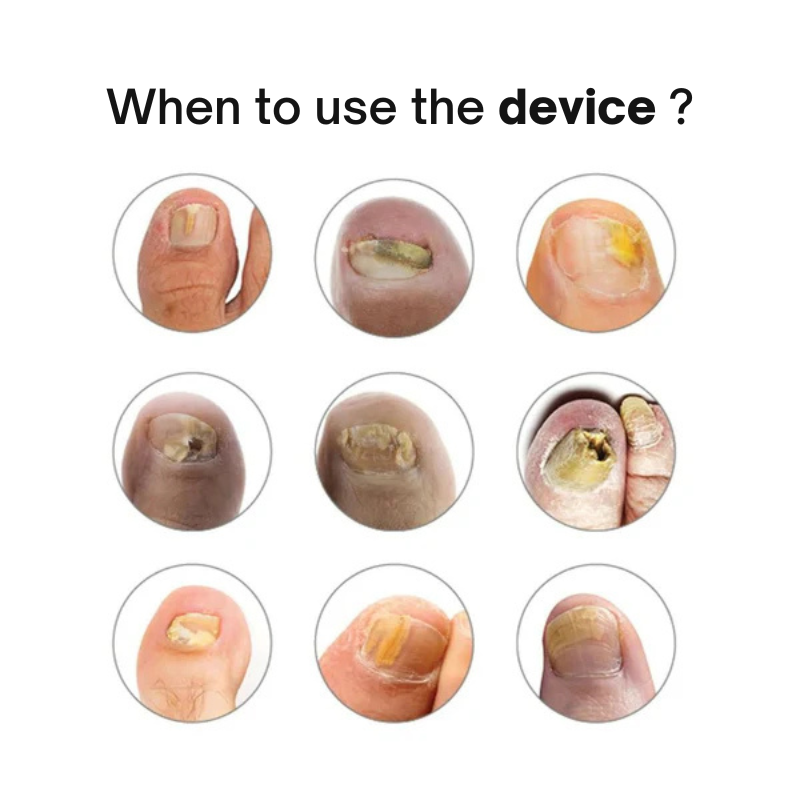 Swissclear™ LLLT Device