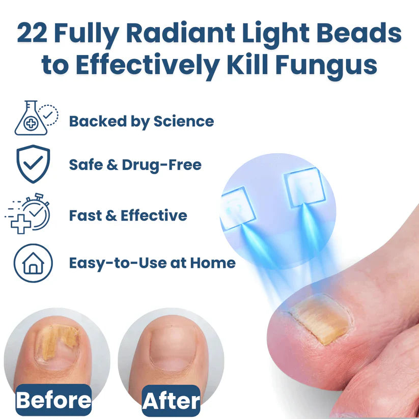 Swissclear™ Therapy Device : Your path to Fungus-Free Nails